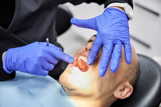 Best Emergency Tooth Extraction in Church Hill, MD